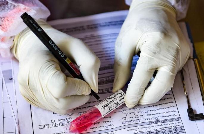 Four more die in Akola district, 479 new positive | अकोला जिल्ह्यात आणखी चौघांचा मृत्यू, ४७९ नवे पॉझिटिव्ह Four more die in Akola district, 479 new positive | अकोला जिल्ह्यात आणखी चौघांचा मृत्यू, ४७९ नवे पॉझिटिव्ह