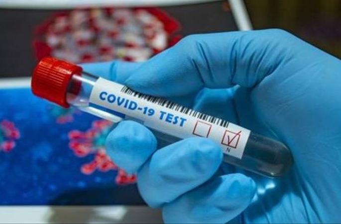 One victim during the day; 13 new positive, 32 corona free | दिवसभरात एकाचा बळी; १३ नवे पॉझिटिव्ह, ३२ कोरोनामुक्त One victim during the day; 13 new positive, 32 corona free | दिवसभरात एकाचा बळी; १३ नवे पॉझिटिव्ह, ३२ कोरोनामुक्त