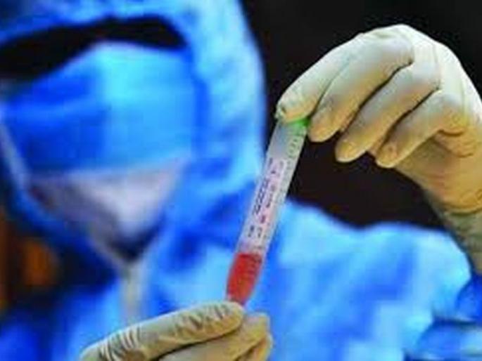 The death of another woman; 72 new corona positive | आणखी एका महिलेचा मृत्यू; ७२ नवे कोरोना पॉझिटिव्ह The death of another woman; 72 new corona positive | आणखी एका महिलेचा मृत्यू; ७२ नवे कोरोना पॉझिटिव्ह