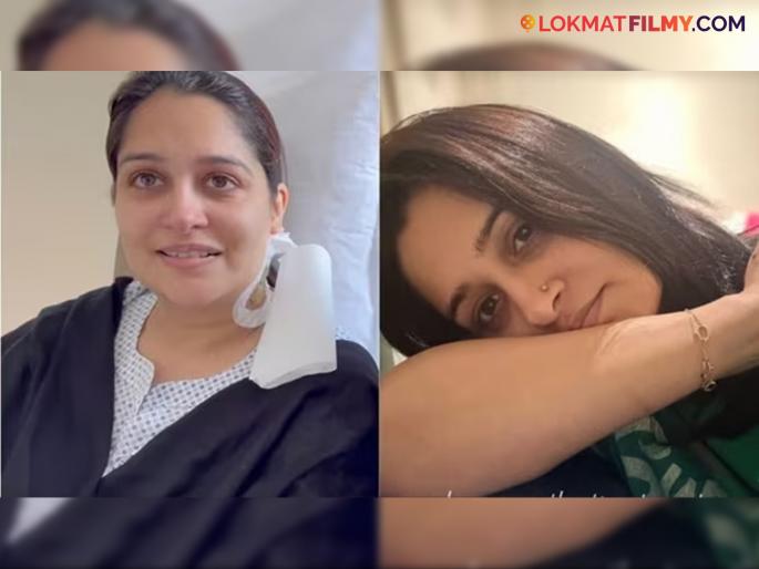 hindi television actress sasural simar ka fame dipika kakar shares health update after targeted therapy to the fans | केसगळती, अंगावर लाल पुरळ, टार्गेटेड थेरपीमुळे होतोय भयंकर त्रास! दीपिका हेल्थ अपडेट देत म्हणाली..