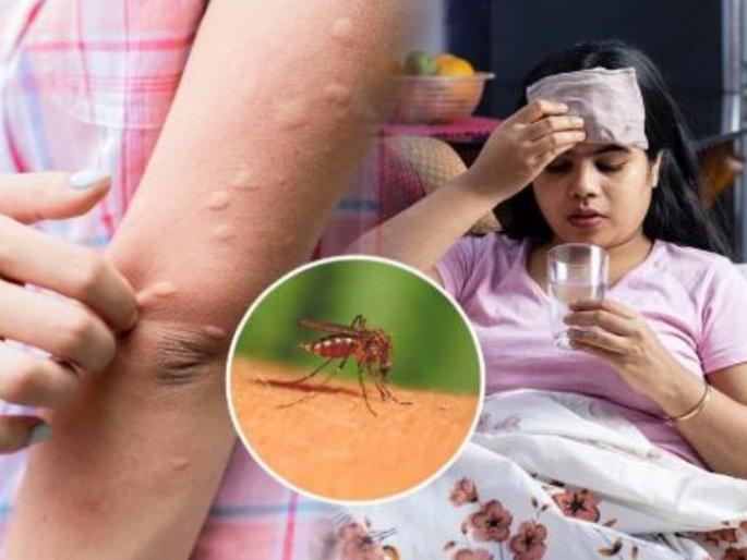 in mumbai although the rain subsided the epidemic malaria and dengue patients increased | पावसाचा जोर ओसरला, तरी साथीची डोकेदुखी वाढली! मलेरिया, डेंग्यूचे रुग्ण वाढले in mumbai although the rain subsided the epidemic malaria and dengue patients increased | पावसाचा जोर ओसरला, तरी साथीची डोकेदुखी वाढली! मलेरिया, डेंग्यूचे रुग्ण वाढले