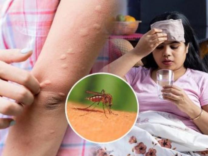 malaria and dengue stings mumbai due to changing climate patients of epidemic diseases increased  | बदलत्या वातावरणामुळे मुंबईला मलेरिया, डेंग्यूचा डंख; साथीच्या आजारांचे रुग्ण वाढले  malaria and dengue stings mumbai due to changing climate patients of epidemic diseases increased  | बदलत्या वातावरणामुळे मुंबईला मलेरिया, डेंग्यूचा डंख; साथीच्या आजारांचे रुग्ण वाढले