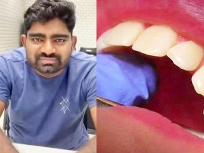 groom to be man dies during smile designing surgery at dental clinic in hyderabad | अरे बापरे! लग्नाआधी दातांची सर्जरी करायला गेला 28 वर्षांचा मुलगा; डेंटल क्लिनिकमध्ये मृत्यू groom to be man dies during smile designing surgery at dental clinic in hyderabad | अरे बापरे! लग्नाआधी दातांची सर्जरी करायला गेला 28 वर्षांचा मुलगा; डेंटल क्लिनिकमध्ये मृत्यू