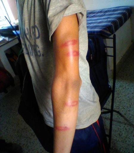In the school ninth class student brutally beaten | शाळेत नववीच्या विद्यार्थ्यास अमानुष मारहाण In the school ninth class student brutally beaten | शाळेत नववीच्या विद्यार्थ्यास अमानुष मारहाण