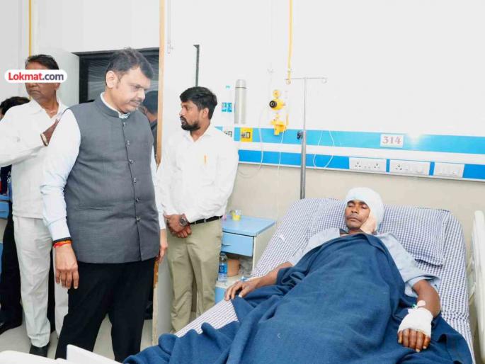 CM Devendra Fadnavis met and inquired about the injured in the leopard attack. | बिबट्याच्या हल्ल्यातील जखमींची मुख्यमंत्री देवेंद्र फडणवीस यांनी भेट घेऊन केली चौकशी CM Devendra Fadnavis met and inquired about the injured in the leopard attack. | बिबट्याच्या हल्ल्यातील जखमींची मुख्यमंत्री देवेंद्र फडणवीस यांनी भेट घेऊन केली चौकशी