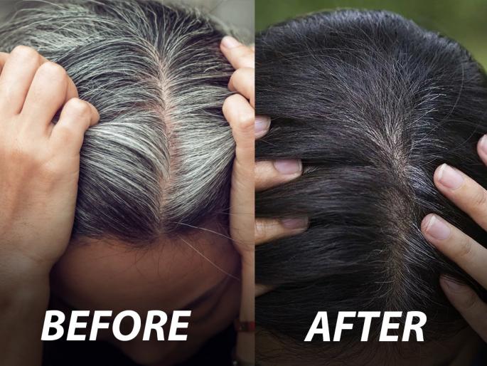 White Hair Removal Oil : white hair baldness problem oil massage neem coconut sesame olive vitamin c | White Hair Removal Oil : पांढरे केस जास्तच वाढत चाललेत? ३ प्रकारच्या तेलांनी मसाज करा, काळ्याभोर केसांसाठी सोपा उपाय