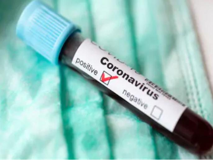 CoronaVirus Marathi News 27 deaths in a day in the state; Diagnosis of 678 patients hrb | CoronaVirus राज्यात दिवसभरात २७ कोरोनाग्रस्तांचा मृत्यू; ६७८ रुग्णांचे निदान CoronaVirus Marathi News 27 deaths in a day in the state; Diagnosis of 678 patients hrb | CoronaVirus राज्यात दिवसभरात २७ कोरोनाग्रस्तांचा मृत्यू; ६७८ रुग्णांचे निदान