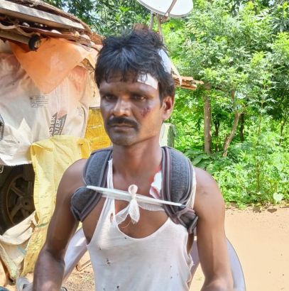 A wild boar hit a motorcycle; Father and son injured | रानडुकराने दिली माेटारसायकलला धडक; वडिलांसह मुलगा जखमी A wild boar hit a motorcycle; Father and son injured | रानडुकराने दिली माेटारसायकलला धडक; वडिलांसह मुलगा जखमी