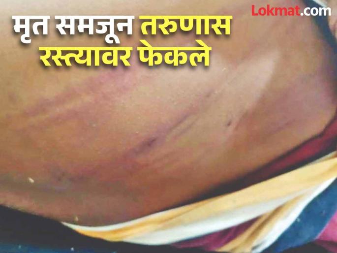 Cruelty reaches its peak in Dharashiv! After inhuman beating, a young man was thrown on the road, presumed dead | धाराशिवमध्ये क्रूरतेचा कळस! अमानुष मारहाणीनंतर मृत समजून तरुणाला रस्त्यावर फेकले Cruelty reaches its peak in Dharashiv! After inhuman beating, a young man was thrown on the road, presumed dead | धाराशिवमध्ये क्रूरतेचा कळस! अमानुष मारहाणीनंतर मृत समजून तरुणाला रस्त्यावर फेकले