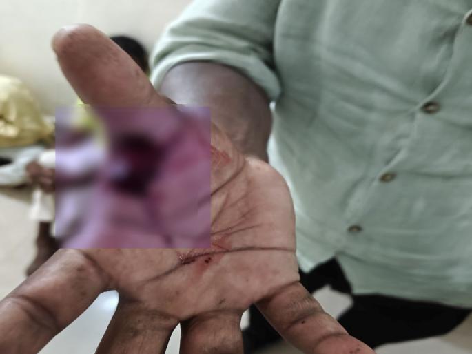 Rage over windmill Police beat up farmer, incident in Tandulwadi | पवनचक्कीवरून राडा; पोलिसांची शेतकऱ्याला मारहाण, तांदुळवाडी येथील घटना Rage over windmill Police beat up farmer, incident in Tandulwadi | पवनचक्कीवरून राडा; पोलिसांची शेतकऱ्याला मारहाण, तांदुळवाडी येथील घटना