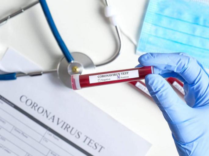 One victim during the day; 10 new positives, 22 coronafree | CoronaVirus : दिवसभरात एकाचा मृत्यू; १० नवे पॉझिटिव्ह, २२ कोरोनामुक्त One victim during the day; 10 new positives, 22 coronafree | CoronaVirus : दिवसभरात एकाचा मृत्यू; १० नवे पॉझिटिव्ह, २२ कोरोनामुक्त