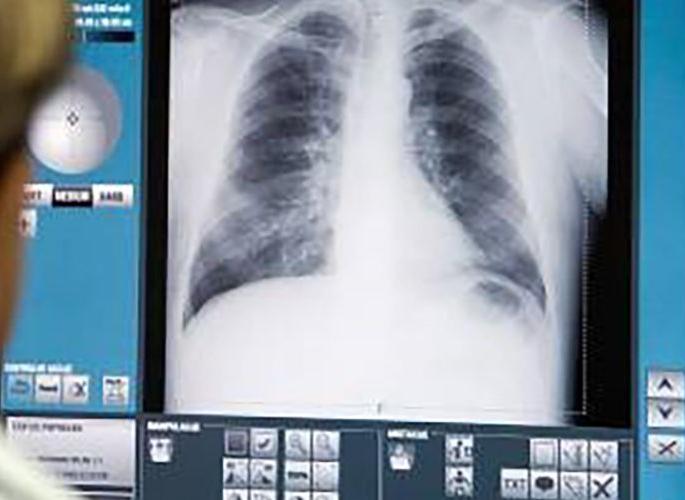 Akola GMC: Digital X-ray machine awaiting installation | Akola GMC : डिजिटल एक्स-रे मशीनला इन्स्टॉलेशनची प्रतीक्षा Akola GMC: Digital X-ray machine awaiting installation | Akola GMC : डिजिटल एक्स-रे मशीनला इन्स्टॉलेशनची प्रतीक्षा