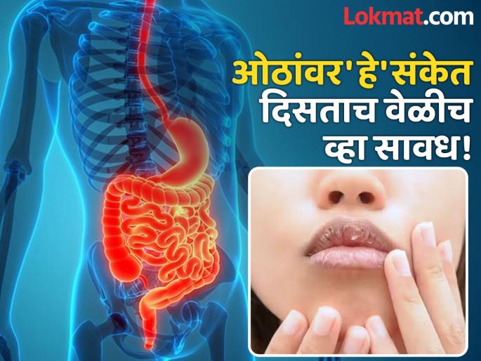Dangerous diseases symptoms you can see on lips | आयुर्वेद डॉक्टरांनुसार ओठांवर दिसतात 'या' गंभीर आजारांचे संकेत, दुर्लक्ष करणं पडेल महागात... Dangerous diseases symptoms you can see on lips | आयुर्वेद डॉक्टरांनुसार ओठांवर दिसतात 'या' गंभीर आजारांचे संकेत, दुर्लक्ष करणं पडेल महागात...