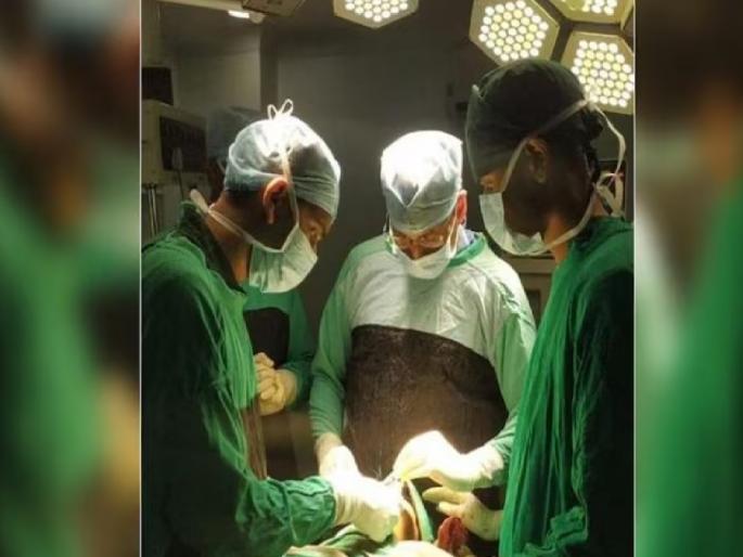 Jharkhand, man did not eat anything from last 20 years, Temporomandibular joint ankylosis operation in Dumka | जन्मापासून तोंड 'शिवलेले', 20 वर्षांपासून धान्याचा एक कणही खाल्ला नाही; असा राहिला जिवंत... Jharkhand, man did not eat anything from last 20 years, Temporomandibular joint ankylosis operation in Dumka | जन्मापासून तोंड 'शिवलेले', 20 वर्षांपासून धान्याचा एक कणही खाल्ला नाही; असा राहिला जिवंत...