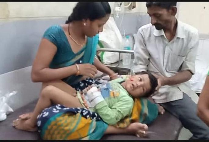 Ten injured, including a child in a dog attack in Akola | कुत्र्याच्या हल्ल्यात चिमुकल्यासह दहा जखमी
