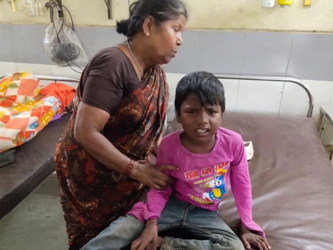 The bitching dog bites 27 people in Akola | पिसाळलेल्या कुत्र्याने घेतला २७ जणांना चावा; महापालिका झोपेत The bitching dog bites 27 people in Akola | पिसाळलेल्या कुत्र्याने घेतला २७ जणांना चावा; महापालिका झोपेत