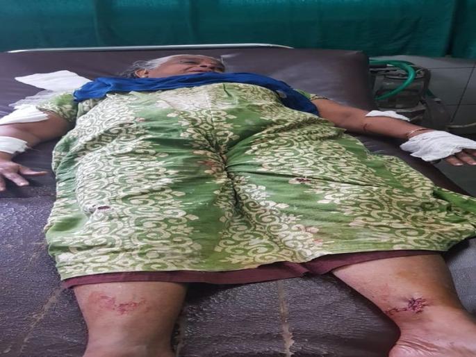 Hades in Kalyan; Wounded female wounded in wartime dogs | कल्याणमध्ये भटक्या कुत्र्यांच्या हल्ल्यात वृद्ध महिला जखमी Hades in Kalyan; Wounded female wounded in wartime dogs | कल्याणमध्ये भटक्या कुत्र्यांच्या हल्ल्यात वृद्ध महिला जखमी