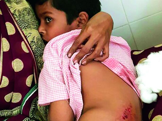 Dog Bite two students at a school premises in Wadegaon | वाडेगाव येथे शाळेच्या आवारात शिरलेल्या कुत्र्याने घेतला दोन विद्यार्थ्यांना चावा Dog Bite two students at a school premises in Wadegaon | वाडेगाव येथे शाळेच्या आवारात शिरलेल्या कुत्र्याने घेतला दोन विद्यार्थ्यांना चावा
