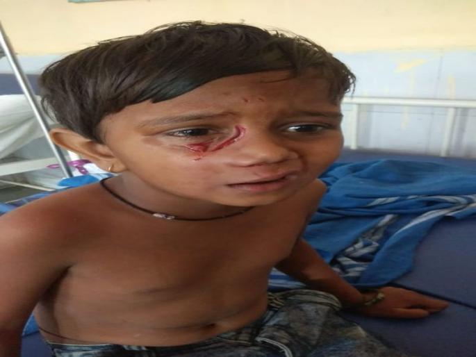 Wandering dogs in Ulhasanagar; At least 7 children have been injured in the attack | उल्हासनगरात भटक्या कुत्र्यांचे थैमान;एकाचवेळी 7 मुलांना चावून केले जखमी Wandering dogs in Ulhasanagar; At least 7 children have been injured in the attack | उल्हासनगरात भटक्या कुत्र्यांचे थैमान;एकाचवेळी 7 मुलांना चावून केले जखमी