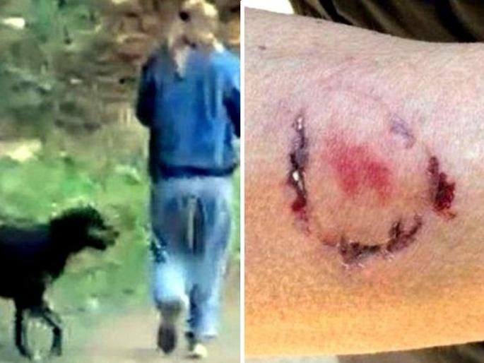 US woman tries to fend off unruly dog with pepper spray gets bitten by the owner | कुत्र्याला घाबरवलं म्हणून महिलेने घेतला महिलेचाच चावा!