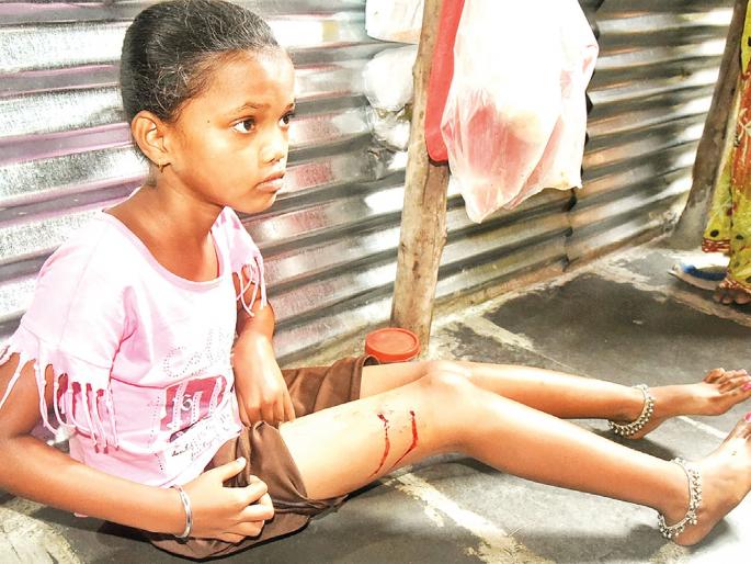 Mokat dogs continue to panic in Panvel Municipality area | पनवेल महापालिका क्षेत्रात मोकाट कुत्र्यांची दहशत कायम Mokat dogs continue to panic in Panvel Municipality area | पनवेल महापालिका क्षेत्रात मोकाट कुत्र्यांची दहशत कायम