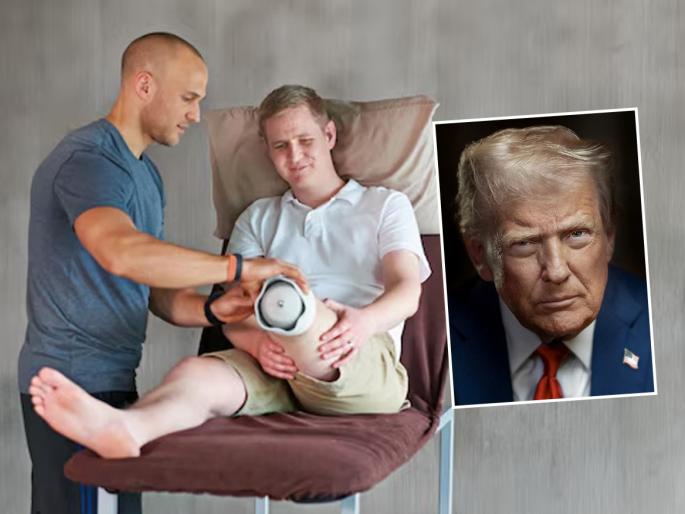 What does amputation means? Donald Trump might face serious treatment says doctor | डोनाल्ड ट्रम्प यांना झालेला त्रास नेमका काय आहे? अँप्यूटेशन म्हणजे करतात काय?