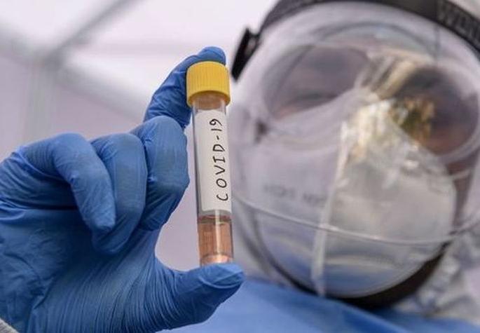 CoronaVirus: 15% of patients in Akola suffer from double mutant strain | CoronaVirus : अकोल्यात १५ टक्के रुग्ण डबल म्युटंट स्ट्रेनचे CoronaVirus: 15% of patients in Akola suffer from double mutant strain | CoronaVirus : अकोल्यात १५ टक्के रुग्ण डबल म्युटंट स्ट्रेनचे