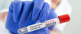 Three thousand less corona tests in Jalgaon than the state average | राज्याच्या सरासरीपेक्षा जळगावात कोरोनाच्या तीन हजार चाचण्या कमी Three thousand less corona tests in Jalgaon than the state average | राज्याच्या सरासरीपेक्षा जळगावात कोरोनाच्या तीन हजार चाचण्या कमी