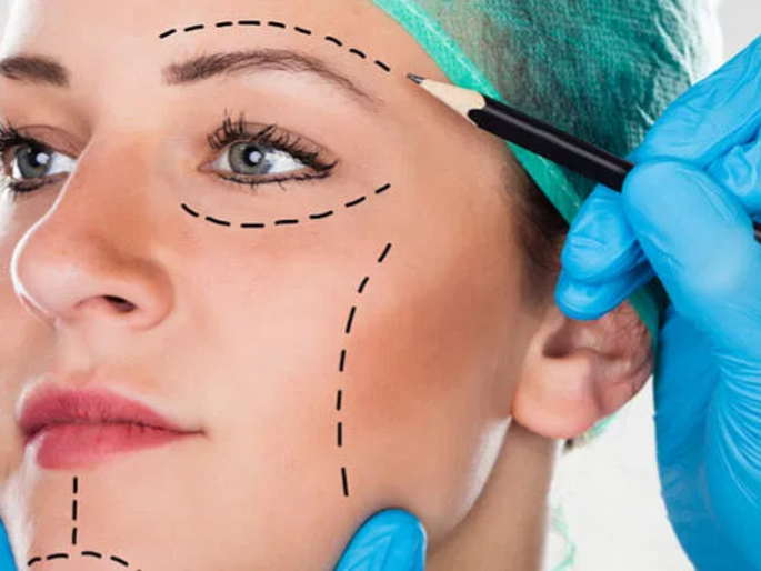 Plastic Surgery Day : You should know these things about Plastic Surgery | Plastic Surgery Day : प्लास्टिक सर्जरीमध्ये प्लास्टिक वापरले जाते का? वाचा प्लास्टिक सर्जरीची A to Z माहिती... Plastic Surgery Day : You should know these things about Plastic Surgery | Plastic Surgery Day : प्लास्टिक सर्जरीमध्ये प्लास्टिक वापरले जाते का? वाचा प्लास्टिक सर्जरीची A to Z माहिती...