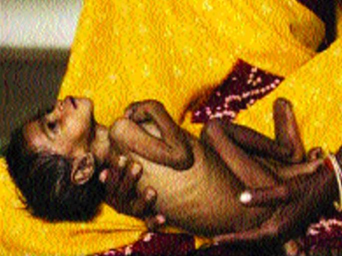 There is no pediatrician in government hospital in taluka | तालुक्यातील शासकीय रुग्णालयात एकही बालरोगतज्ज्ञ नाही There is no pediatrician in government hospital in taluka | तालुक्यातील शासकीय रुग्णालयात एकही बालरोगतज्ज्ञ नाही