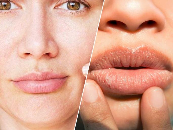 Does your lips turn dark in winter? Does your skin gets dry? Find out what to do, try these remedies | हिवाळ्यात ओठांजवळ काळवंडते? त्वचा ताणली जाऊन झोंबते? पाहा काय करायचे, वेळीच उपाय करा कारण ..... Does your lips turn dark in winter? Does your skin gets dry? Find out what to do, try these remedies | हिवाळ्यात ओठांजवळ काळवंडते? त्वचा ताणली जाऊन झोंबते? पाहा काय करायचे, वेळीच उपाय करा कारण .....