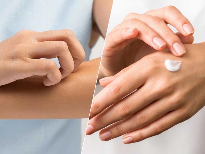 Does your skin become dry and flaky in winter? Just 5 remedies, your skin will become soft and smooth like cotton. | हिवाळ्यात त्वचा कोरडी आणि पांढरी फटफटीत होते ? फक्त ५ उपाय, त्वचा होईल मऊ मुलायम कापसासारखी Does your skin become dry and flaky in winter? Just 5 remedies, your skin will become soft and smooth like cotton. | हिवाळ्यात त्वचा कोरडी आणि पांढरी फटफटीत होते ? फक्त ५ उपाय, त्वचा होईल मऊ मुलायम कापसासारखी