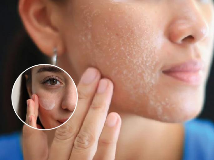 Does your skin crack in winter? White spots on your face? 4 solutions, your skin will look beautiful and soft even in winter | हिवाळ्यात त्वचा सारखी फुटते? चेहर्‍यावर पांढरे डाग? ४ उपाय, थंडीतही त्वचा दिसेल सुंदर मऊमुलायम