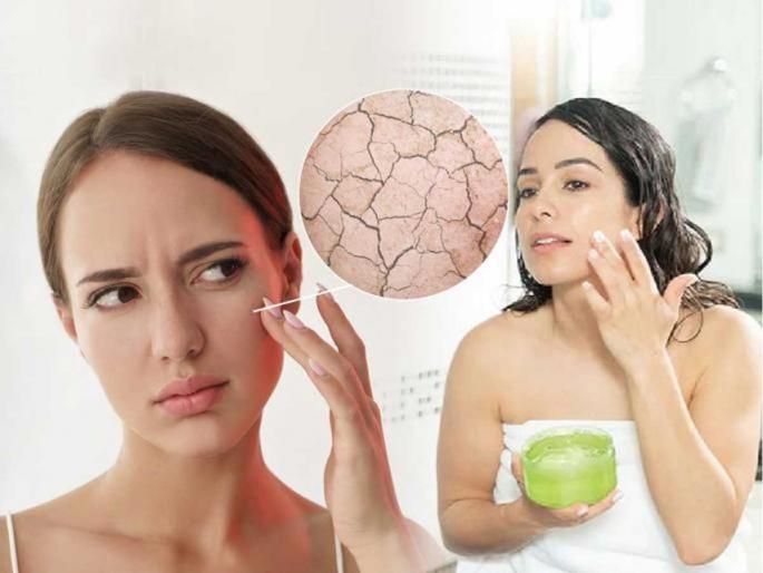 Dry skin means constant itching and red rashes, take care of dry skin like this - avoid serious diseases | ड्राय स्किन म्हणजे सतत खाज आणि लालसर पुरळ , कोरड्या त्वचेची ‘अशी’ काळजी घ्या-गंभीर आजार टाळा Dry skin means constant itching and red rashes, take care of dry skin like this - avoid serious diseases | ड्राय स्किन म्हणजे सतत खाज आणि लालसर पुरळ , कोरड्या त्वचेची ‘अशी’ काळजी घ्या-गंभीर आजार टाळा