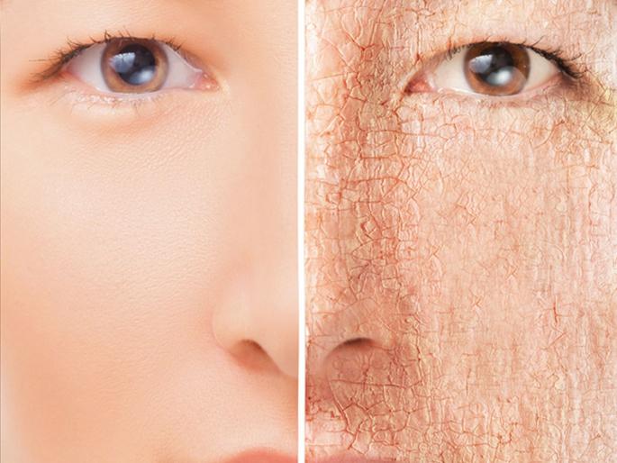 Beauty Tips winter skin care tips | हिवाळ्यात अशी घ्या त्वचेची काळजी; वापरा 'या' सोप्या टिप्स Beauty Tips winter skin care tips | हिवाळ्यात अशी घ्या त्वचेची काळजी; वापरा 'या' सोप्या टिप्स