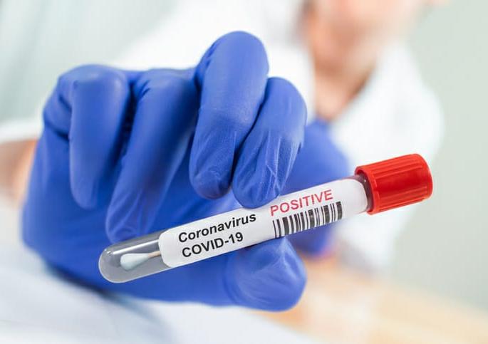 Corona patient figure in Mira Bhayandar 242; 7 new patients throughout the day | मीरा भाईंदरमध्ये कोरोना रुग्णाचा आकडा 242 ; दिवसभरात 7 नवीन रुग्ण 