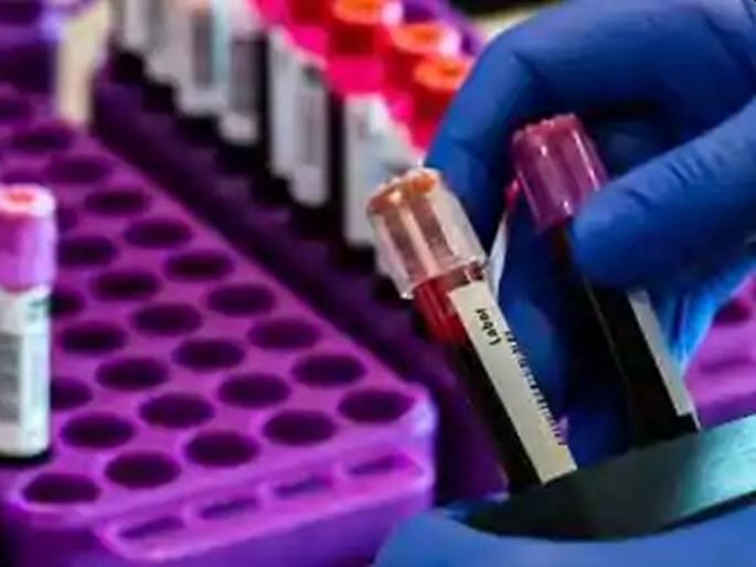 CoronaVirus Haridwar to Satara via Mumbai; Corona Patient journey put in tension hrb | CoronaVirus हरिद्वार ते सातारा व्हाया मुंबई; कोरोनाबाधिताचा प्रवास झोप उडविणारा