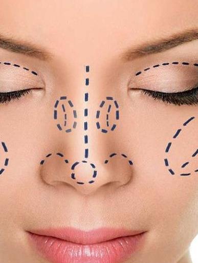 The amount of cosmetic surgery of the nose is higher; Thousands of surgeries per year in Vidarbha | नाकाची कॉस्मेटिक सर्जरीचे प्रमाण अधिक; विदर्भात वर्षाला हजार शस्त्रक्रिया The amount of cosmetic surgery of the nose is higher; Thousands of surgeries per year in Vidarbha | नाकाची कॉस्मेटिक सर्जरीचे प्रमाण अधिक; विदर्भात वर्षाला हजार शस्त्रक्रिया