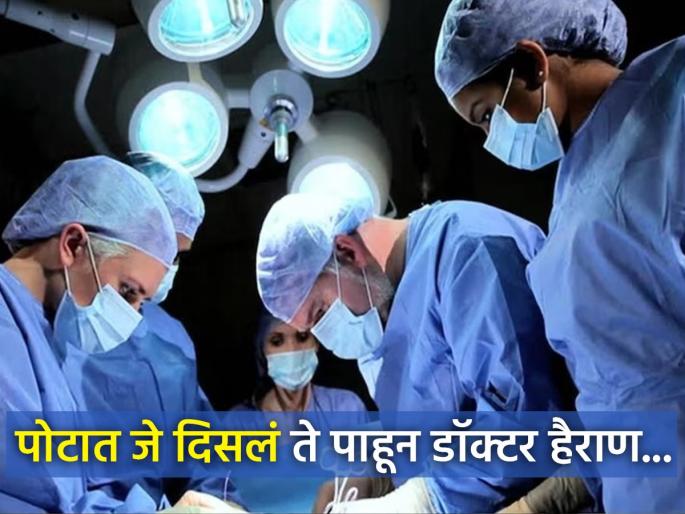 Doctors find living fly in man intestines during colonoscopy | कॅन्सरच्या चेकअपसाठी आलेल्या रूग्णाच्या पोटात दिसलं असं काही, बघून डॉक्टरही चक्रावले Doctors find living fly in man intestines during colonoscopy | कॅन्सरच्या चेकअपसाठी आलेल्या रूग्णाच्या पोटात दिसलं असं काही, बघून डॉक्टरही चक्रावले