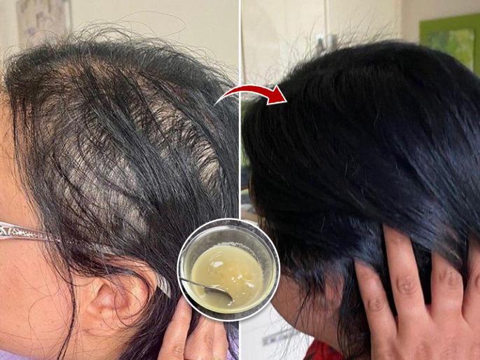 Fast Hair Growth Natural Home made hair Serum : 1 easy natural remedy for long hair within a month, hair fall will also reduce... | महिन्याभरात केस दाट-लांबसडक होण्यासाठी १ सोपा नॅचरल उपाय, केसगळतीही होईल कमी...