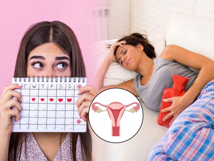 Reasons and solution behind irregular Menstrual cycle : No period for 2-3 months? Having irregular periods due to PCOS-PCOD? Doctor says.. | २-३ महिने पाळी येत नाही? PCOS-PCOD असल्याने अनियमित पाळीचा त्रास आहे? डॉक्टर सांगतात..