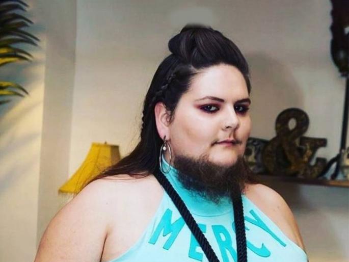 Woman started growing beard at 13 used to shave it twice now embracing her facial hair | 13 वर्षाची असतानापासून दिवसातून 2 वेळा शेव करत होती ही महिला, आता पुरूषांसारखी ठेवते दाढी! Woman started growing beard at 13 used to shave it twice now embracing her facial hair | 13 वर्षाची असतानापासून दिवसातून 2 वेळा शेव करत होती ही महिला, आता पुरूषांसारखी ठेवते दाढी!