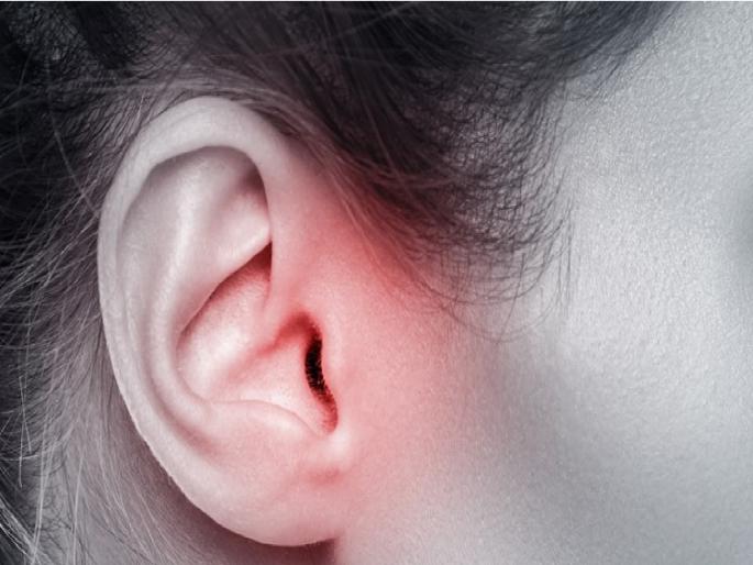 Take care that ear diseases may increase during rainy season | पावसाळ्यात कानाचे आजार बळावण्याची शक्यता, अशी घ्या काळजी Take care that ear diseases may increase during rainy season | पावसाळ्यात कानाचे आजार बळावण्याची शक्यता, अशी घ्या काळजी