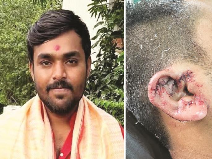 Attempt to cut off child's ear and nose, saying "Why are you looking at me?"; A heinous act by a drug addict | माझ्याकडे का पाहिले म्हणत मुलाचा कान, नाक कापायचा प्रयत्न; नशेखोराचे अघोरी कृत्य