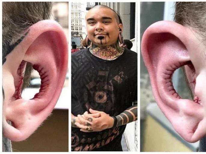 Body modification enthusiast has part of ear removed in controversial procedure | ऐकण्याची क्षमता वाढवण्यासाठी कानाची अजब सर्जरी, फोटो झाले व्हायरल! Body modification enthusiast has part of ear removed in controversial procedure | ऐकण्याची क्षमता वाढवण्यासाठी कानाची अजब सर्जरी, फोटो झाले व्हायरल!