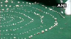 shocking...! 526 teeths found in 7 years old boy's mouth; The doctors also shocked | अबब...मुलाच्या तोंडात आढळला तब्बल 526 दातांचा पुंजका; डॉक्टरांनाही बसला धक्का