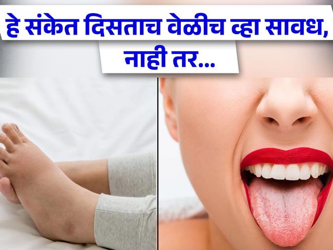 Swollen feet white tongue unusual eyes changes in moles is the sign of serious health conditions | सुजलेले पाय आणि जिभ पांढरी...शरीरात दिसतील 'हे' संकेत तर समजा काहीतरी गडबड आहे! Swollen feet white tongue unusual eyes changes in moles is the sign of serious health conditions | सुजलेले पाय आणि जिभ पांढरी...शरीरात दिसतील 'हे' संकेत तर समजा काहीतरी गडबड आहे!