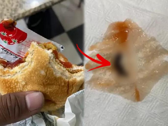 Customer Chewed Half Of The Scorpion Along With The Burger At A Restaurant In Jaipur | बापरे! बर्गर तोंडात घेताच युवकानं जे पाहिलं त्यानंतर त्याला थेट हॉस्पिटल गाठावं लागलं Customer Chewed Half Of The Scorpion Along With The Burger At A Restaurant In Jaipur | बापरे! बर्गर तोंडात घेताच युवकानं जे पाहिलं त्यानंतर त्याला थेट हॉस्पिटल गाठावं लागलं