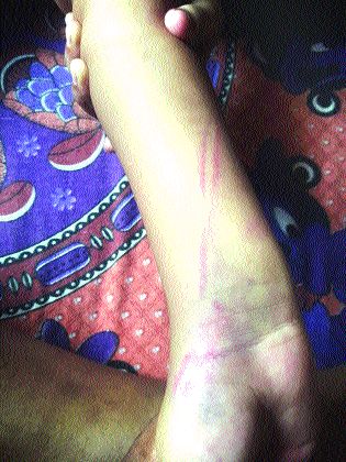 A nine-year-old girl was beaten up by a non-study | अभ्यास न केल्याने शिक्षिकेची नऊ वर्षांच्या मुलीला मारहाण A nine-year-old girl was beaten up by a non-study | अभ्यास न केल्याने शिक्षिकेची नऊ वर्षांच्या मुलीला मारहाण