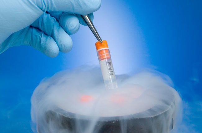 Egg freezing of 10 to 15 women in Nagpur every year | नागपुरात वर्षाकाठी १० ते १५ महिलांचे ‘एग्ज फ्रीजिंग’ Egg freezing of 10 to 15 women in Nagpur every year | नागपुरात वर्षाकाठी १० ते १५ महिलांचे ‘एग्ज फ्रीजिंग’